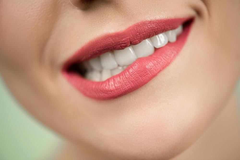 cosa vuol dire ridere a denti stretti